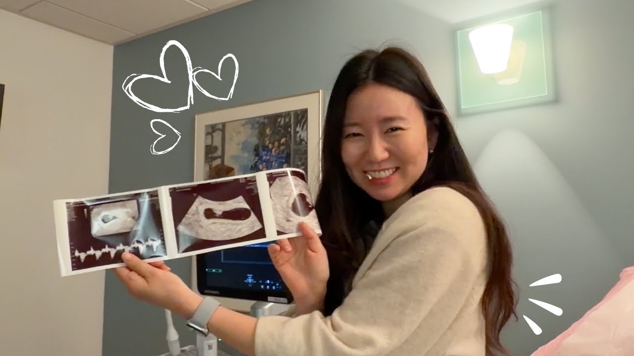 Surprise pregnancy after infertility!