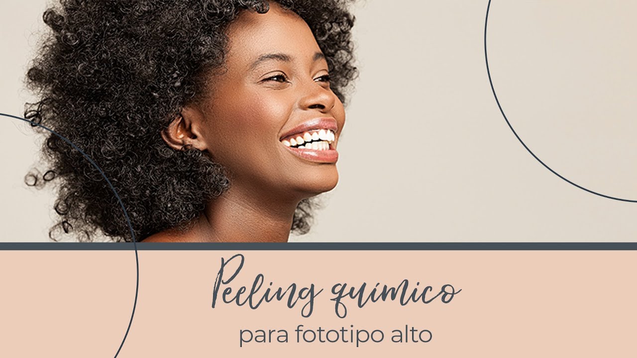Estética em Ação: Peeling Químico para fototipo alto