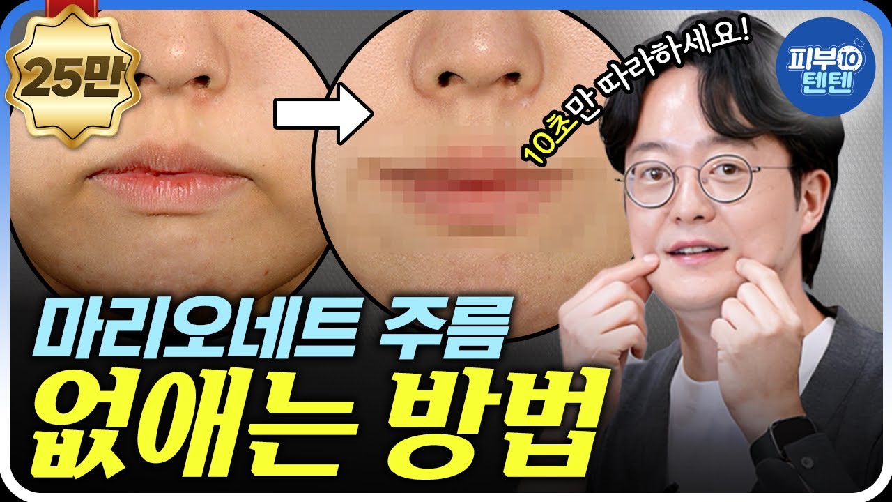 수술없이 마리오네트 주름, 입가주름 없애는 방법! | 피부과 전문의가 알려주는 10초 운동법까지 대공개! 축 늘어진 불독살, 심술보 관리에 #티타늄리프팅