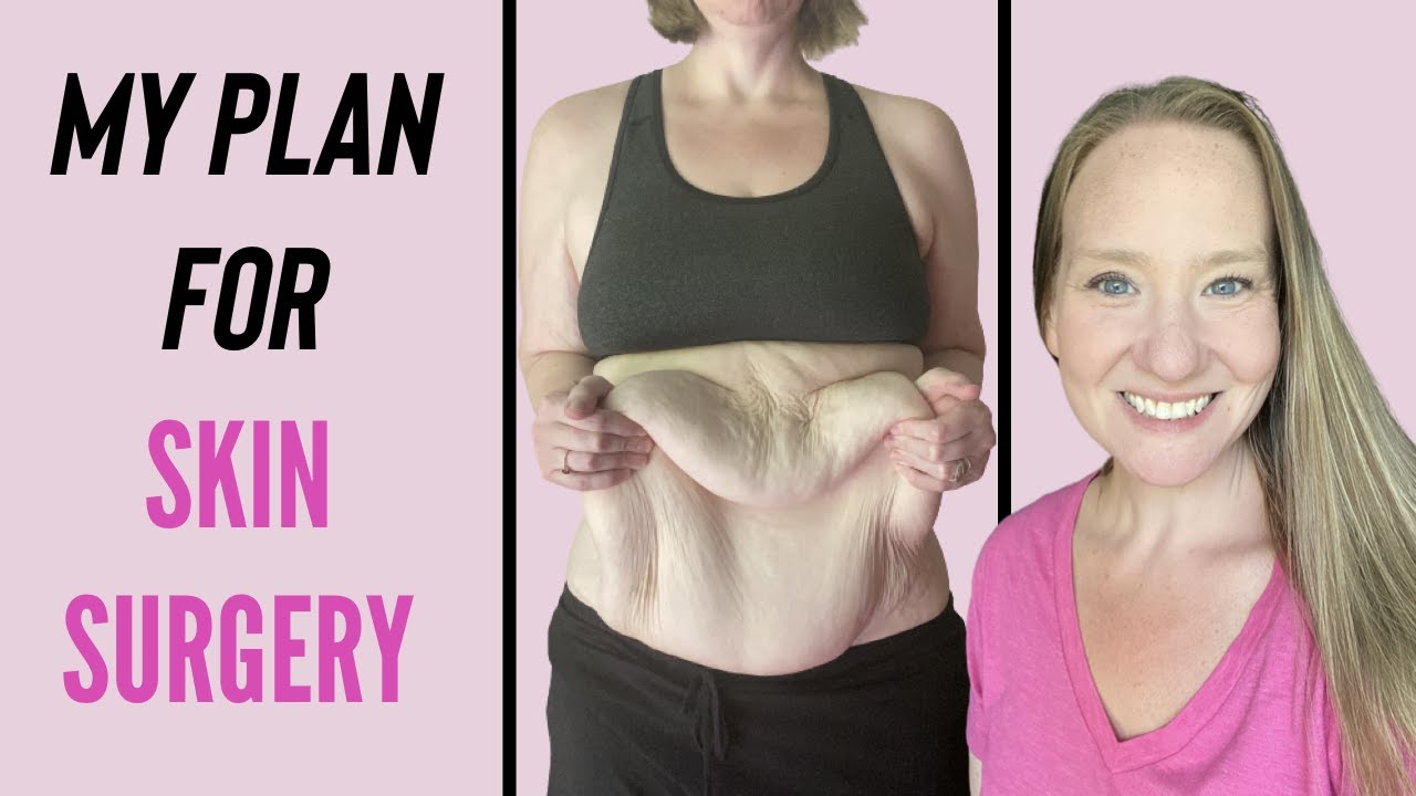 My Plan for Excess Skin Removal Surgery | Skin Surgery Consult Appointment #skinremoval #weightloss