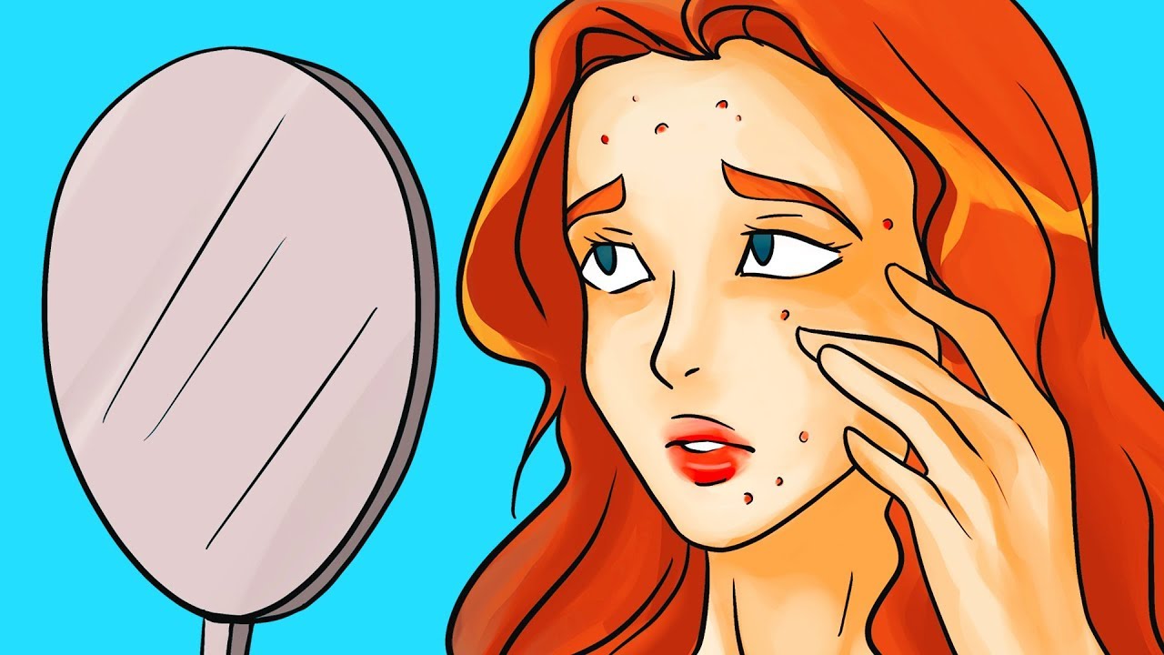 10 Miti Sull’Acne A Cui Fare Attenzione