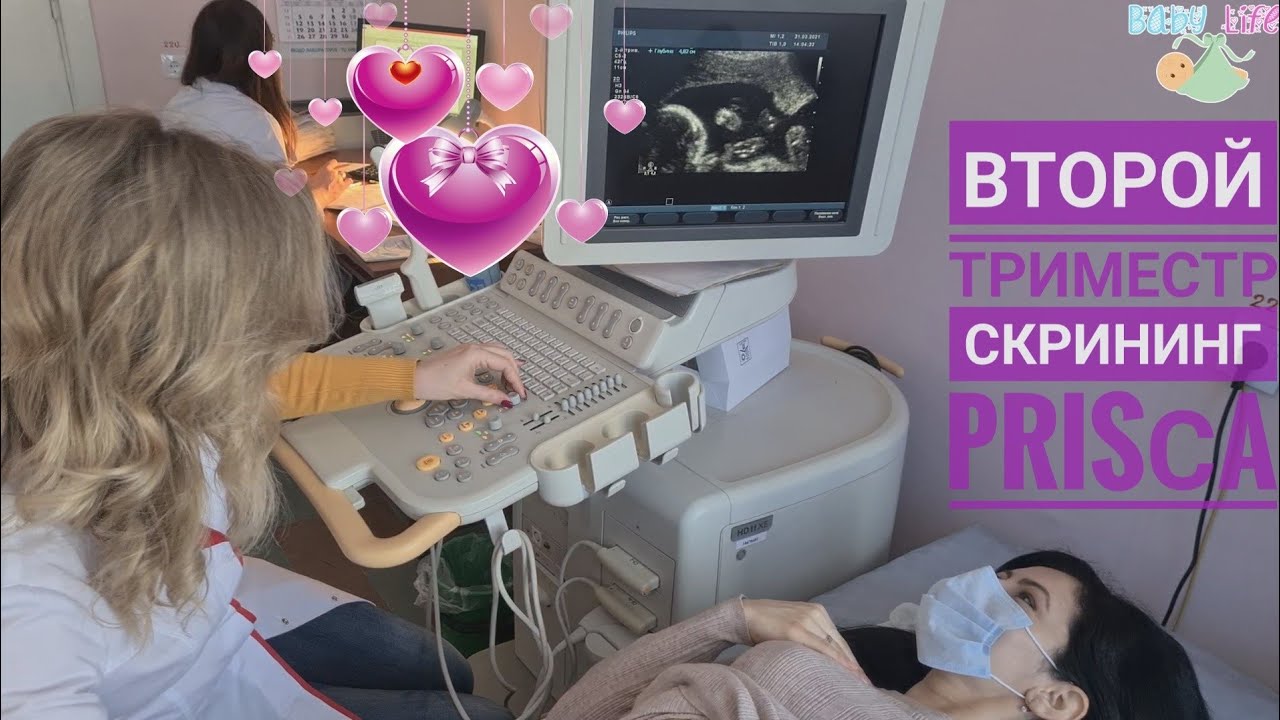 Скрининг, PRISCA ll 🤰Беру Вас на УЗИ 🥰