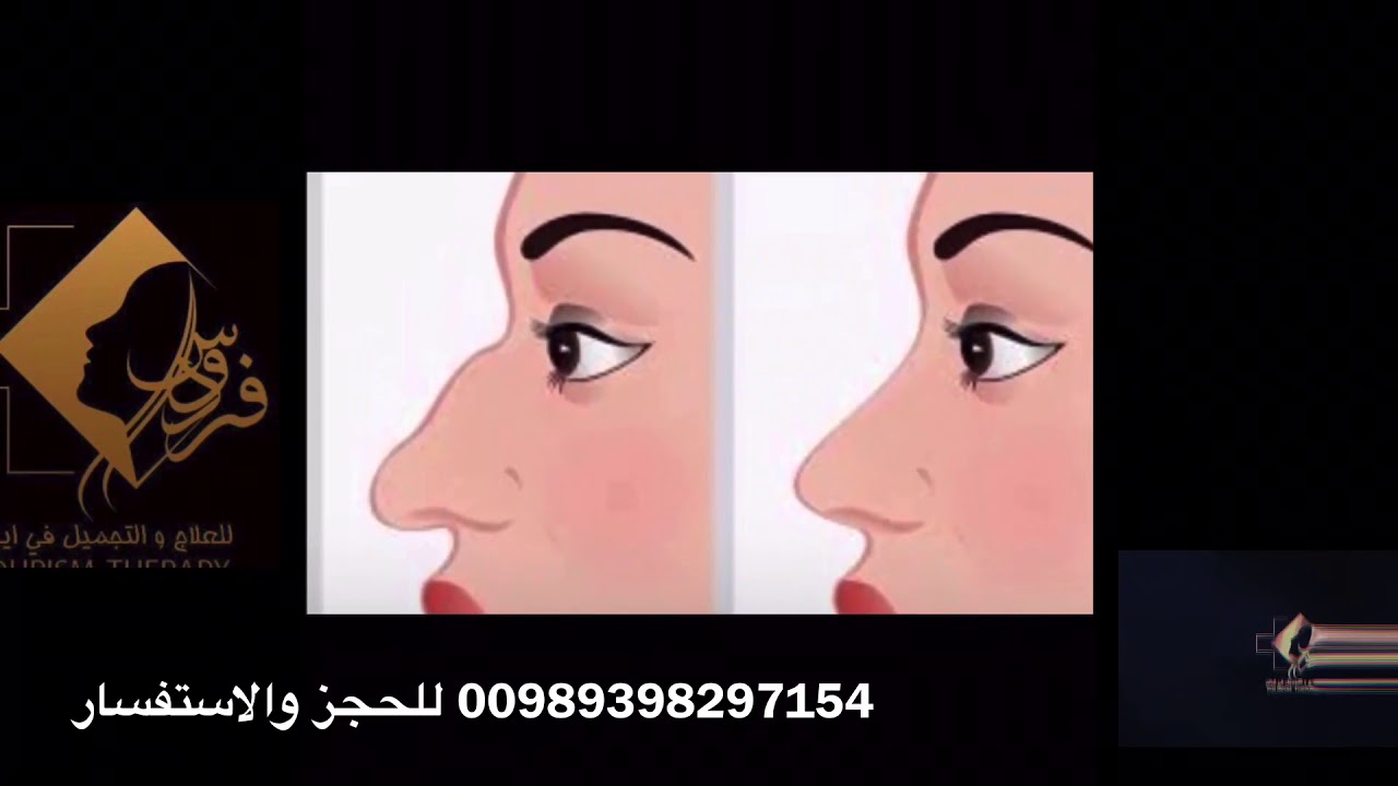 الانف اللحمي دكتور مهدي بخشايي جراحة تجميل الانف / ما هو الانف اللحمي والعظمي 00989398297154