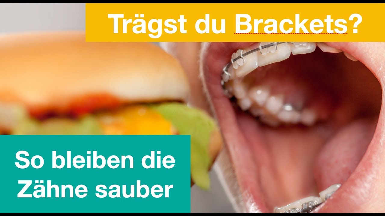 Pimp my teeth