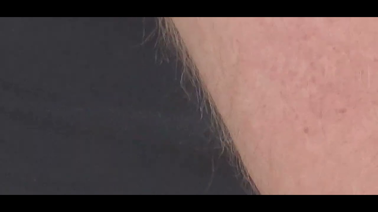1MADL Challenge Attempt 1