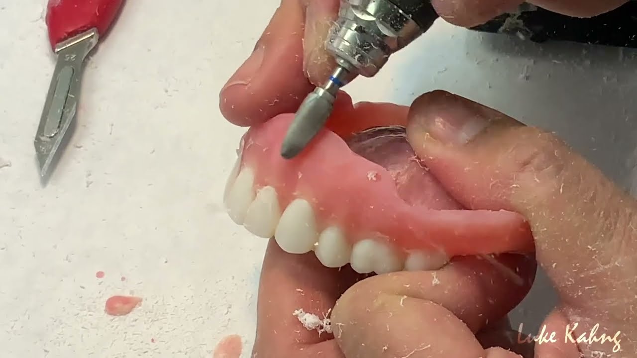 Loose Denture Relining