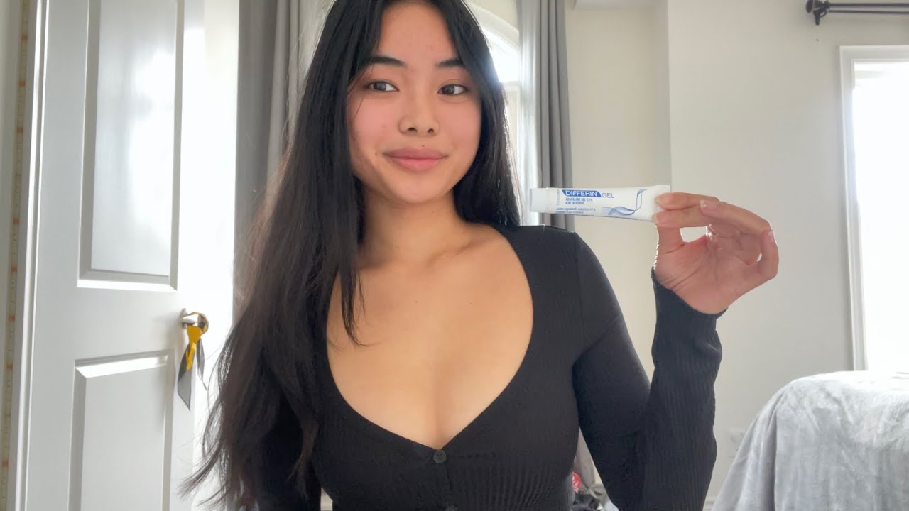 My 3 Month Differin Journey (Before & After Pictures at the End!!)