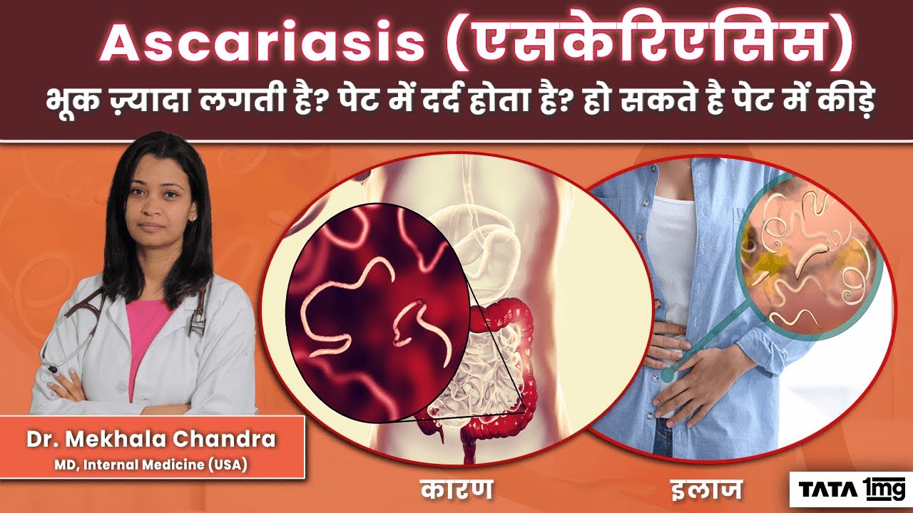Ascariasis (एसकेरिएसिस): भूक ज़्यादा लगती है? पेट में दर्द होता है? हो सकते है पेट में कीड़े