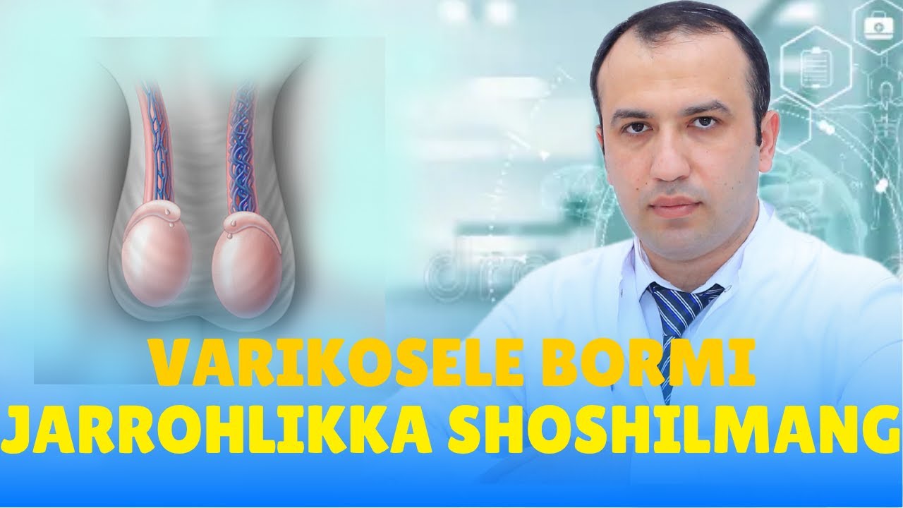 VARIKOSELENI OPERATSIYAYIZ DAVOLASH MUMKINMI?