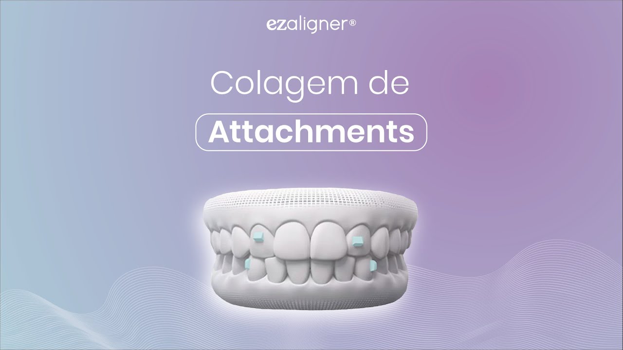 Colagem de Attachments - Educa ez