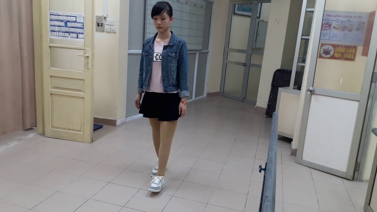 Chân giả