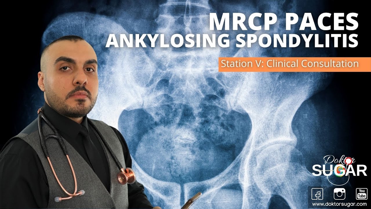MRCP PACES - Station 5 - Ankylosing Spondylitis