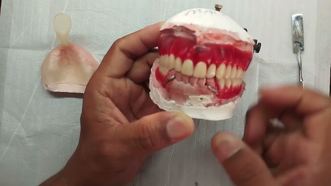 É ASSIM MESMO QUE MONTA UMA PRÓTESE DENTÁRIA??