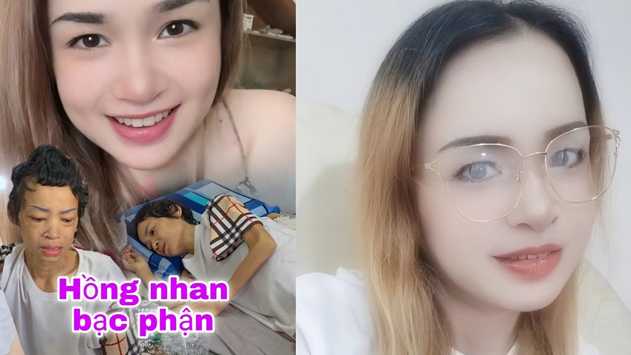Cô gái xinh đẹp có chồng Mã Lai nhưng lúc cuối đời phải thui thủi 1 mình vì căn bệnh phụ nữ