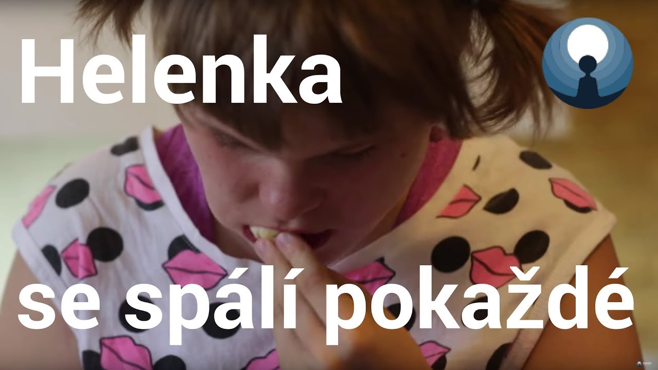 Helenka se spálí pokaždé