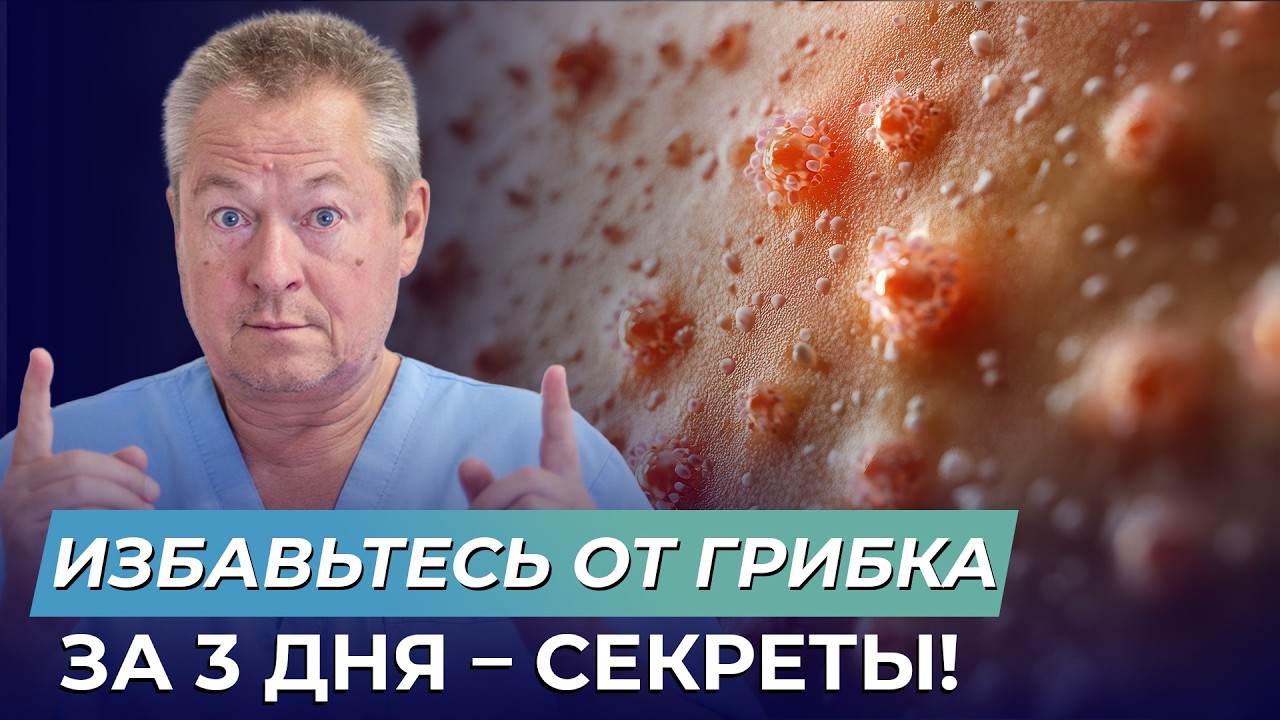 Как НАВСЕГДА избавиться от грибка в 2025 году?