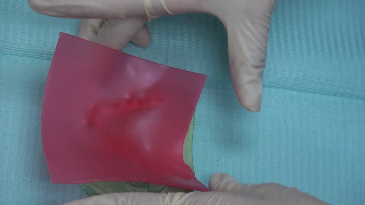 4  BASE PLATE & OCCLUSAL RIM