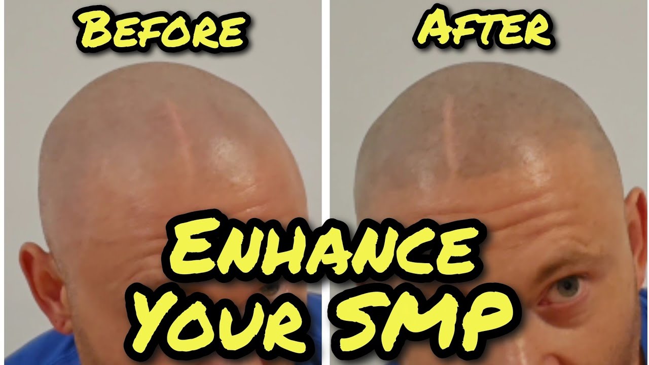 Make Light Scalp Micropigmentation DARK!