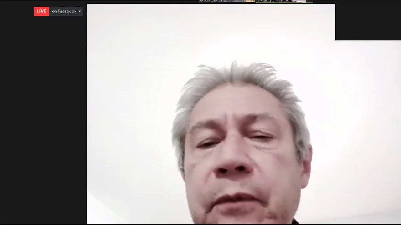 Dr. Luis Badani - Diseño de sonrisa con toxina botulinica; estética facial y dental complementada