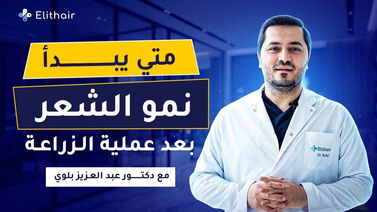 متى يبدأ نمو الشعر المزروع؟ وهل يمكن يتساقط الشعر بعد الزراعة؟ | مع د.بلوي