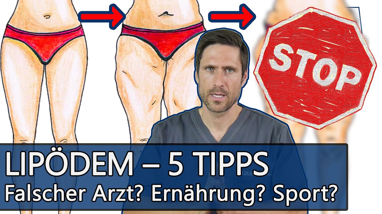 Lipödem: Was kann man tun wenn man betroffen ist: Ernährung? Abnehmen? Sport? Meine 5 Tipps für Sie!