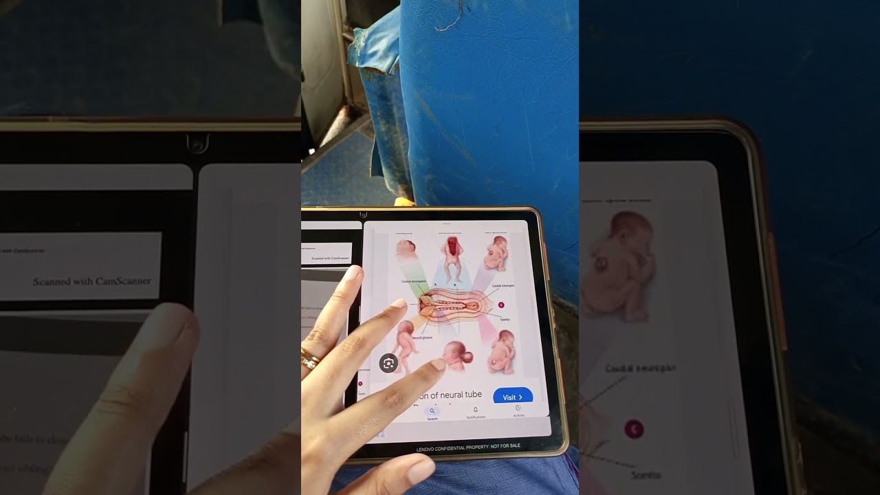 Ch 7 prenatal diagnosis,obstetrics, Irfan Masood quick review