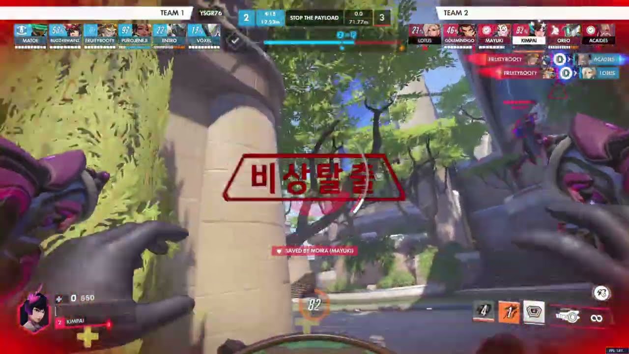 D.VA GAMEPLAY RANKED (SILVER)