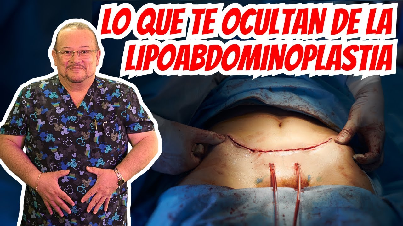 Este Procedimiento Quirúrgico Cambia Todo Lo Que Sabías