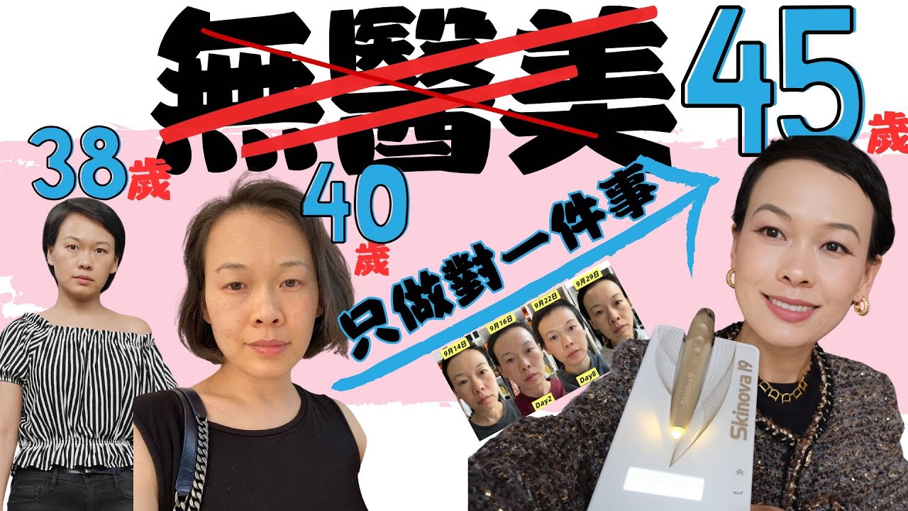 45岁无医美逆生长秘诀！超声美容黑科技Skinova 19原理大揭秘+保姆级教程‼️@2lezi