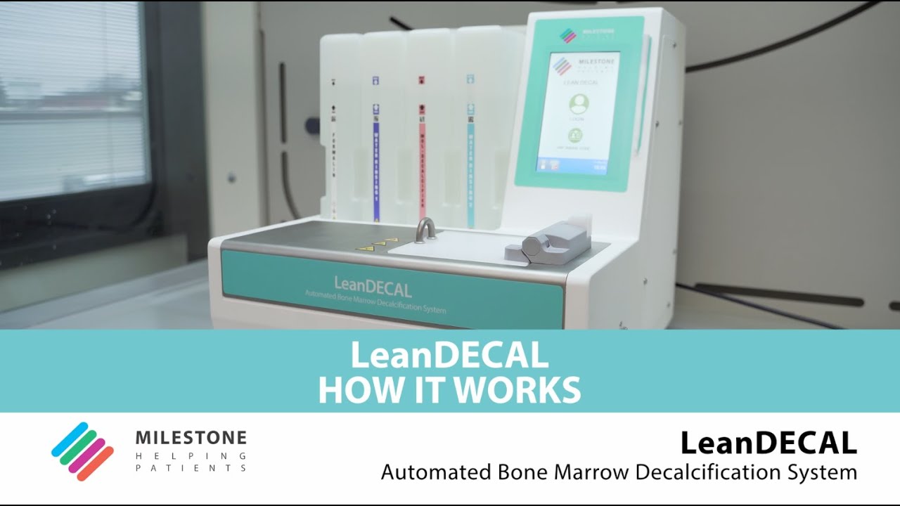 LeanDECAL | How it works