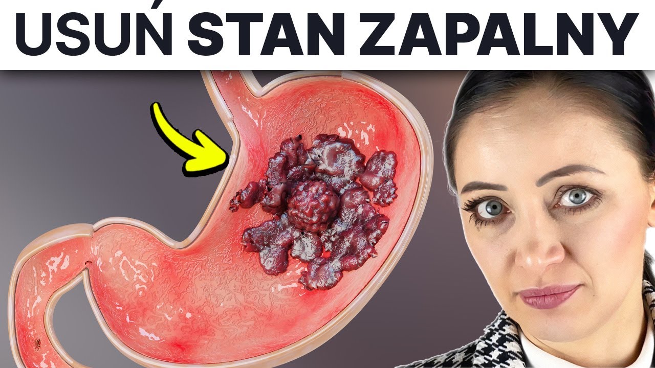 Lista * CO JEŚĆ * by usunąć stan zapalny żołądka i dwunastnicy