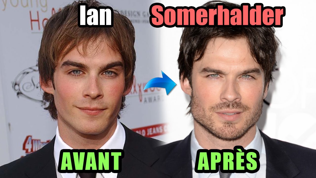 IAN SOMERHALDER : SON VISAGE A BEAUCOUP CHANGÉ, recours à de la chirurgie ou médecine esthétique ?