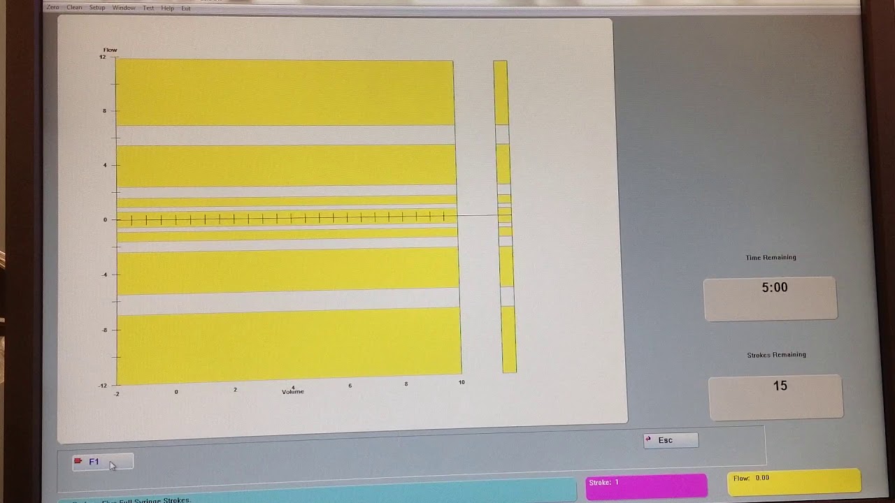 W2 Calibration