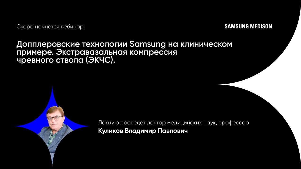 Допплеровские технологии Samsung на клиническом примере. Экстравазальная компрессия чревного ствола.
