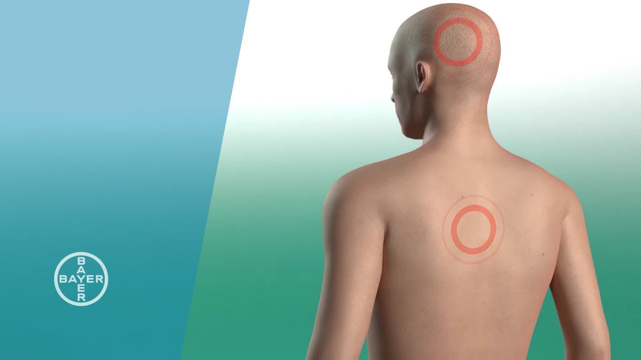 How Aspirin Works