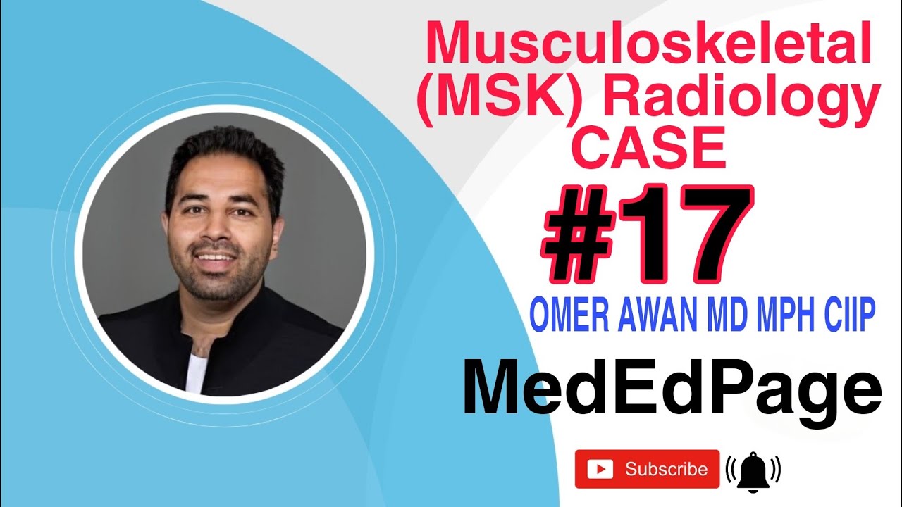 MSK CASE #17: How to evaluate a bone lesion?