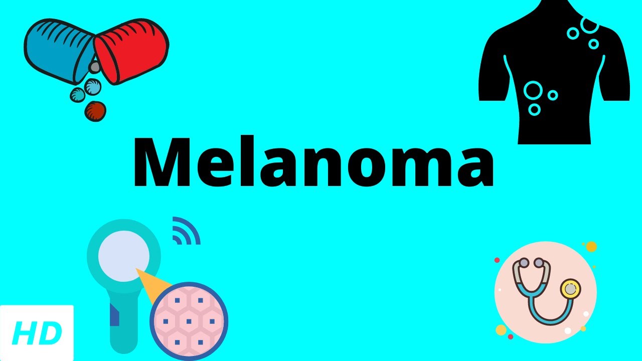 Melanoma, Causes, Signs and Symptoms, DIagnosis and Treatment.