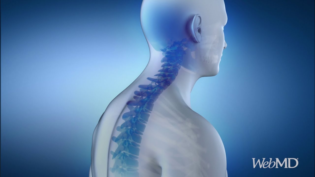 Easy Ways to Improve Your Posture | WebMD