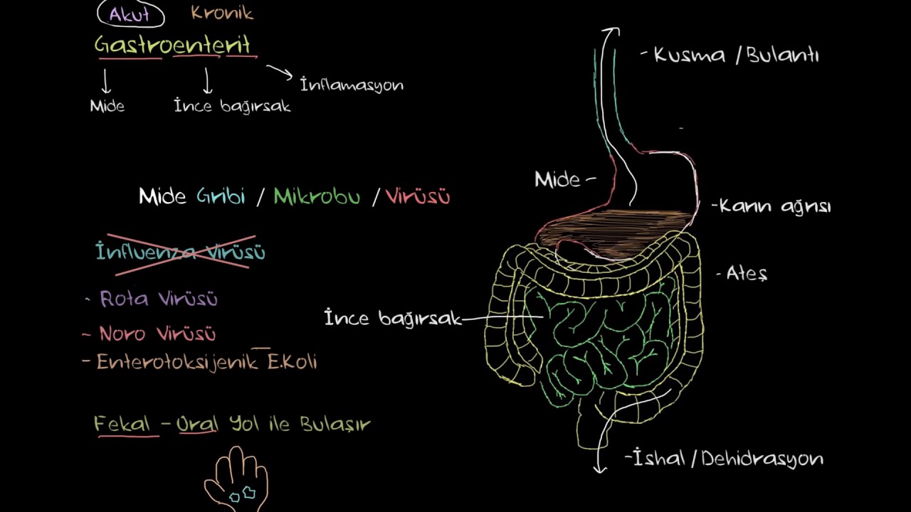 Gastroenterit (Mide İltihabı) Nedir? (Sağlık ve Tıp)