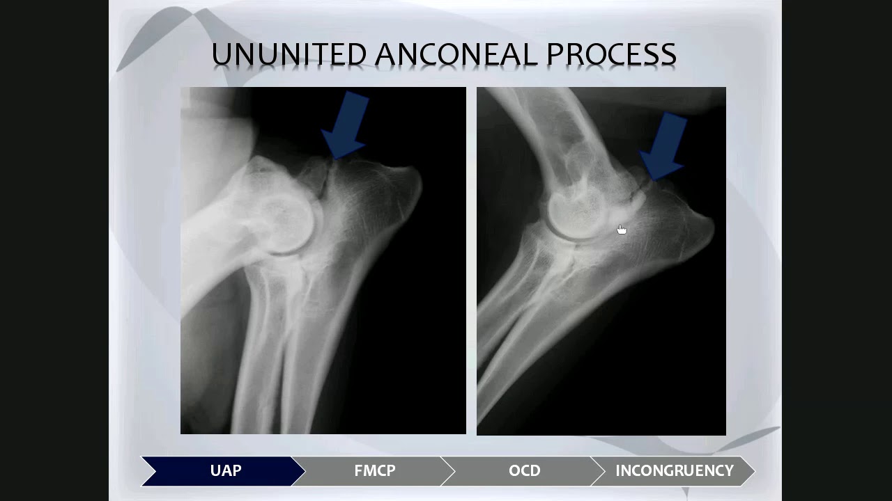 Lecture 8 MSK Elbow dysplasia
