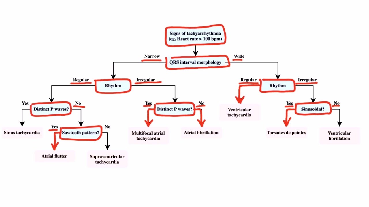 Tachyarrhythmias III for the USMLE Step 2