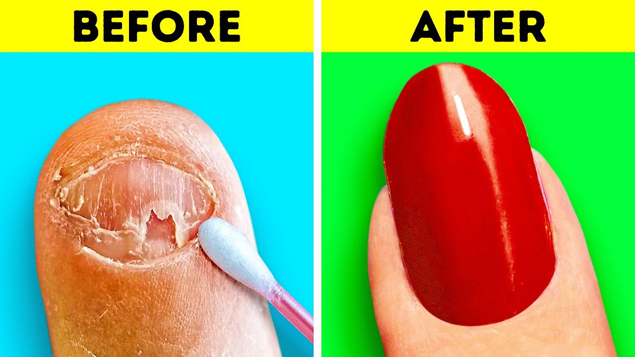 Amazing Nail Transformation || Girly Beauty Tricks