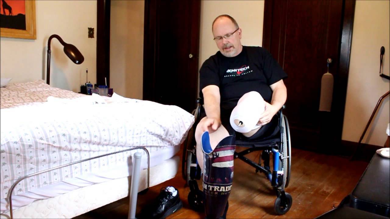 Putting on My Prosthetic Leg