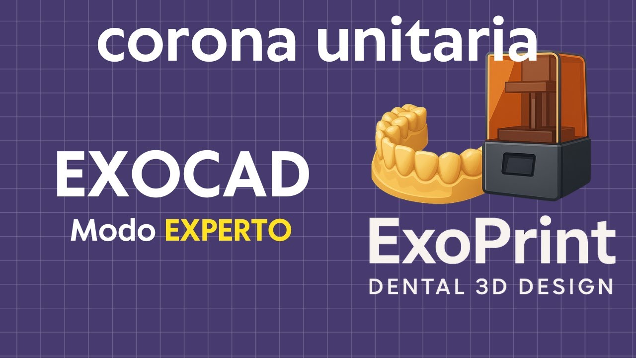 Diseño de corona unitaria en modo experto EXOCAD