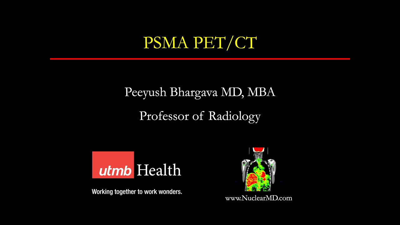 PSMA PET-CT