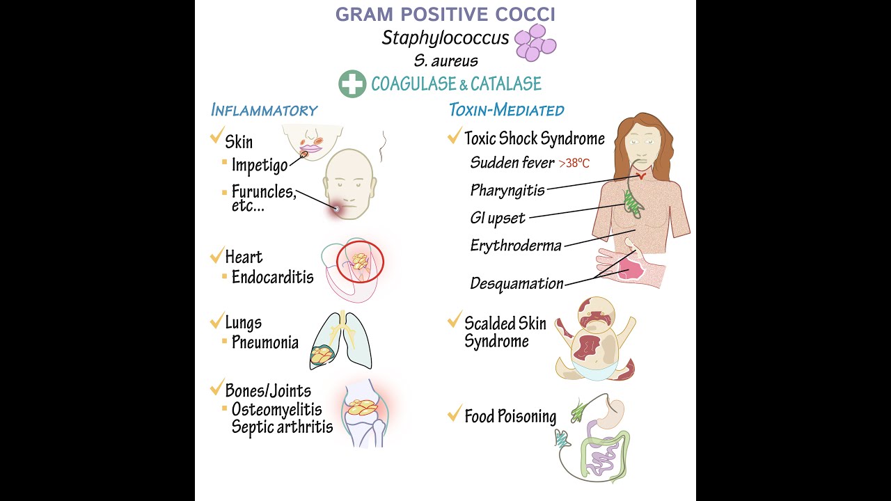 Gram Positive Cocci: Overview