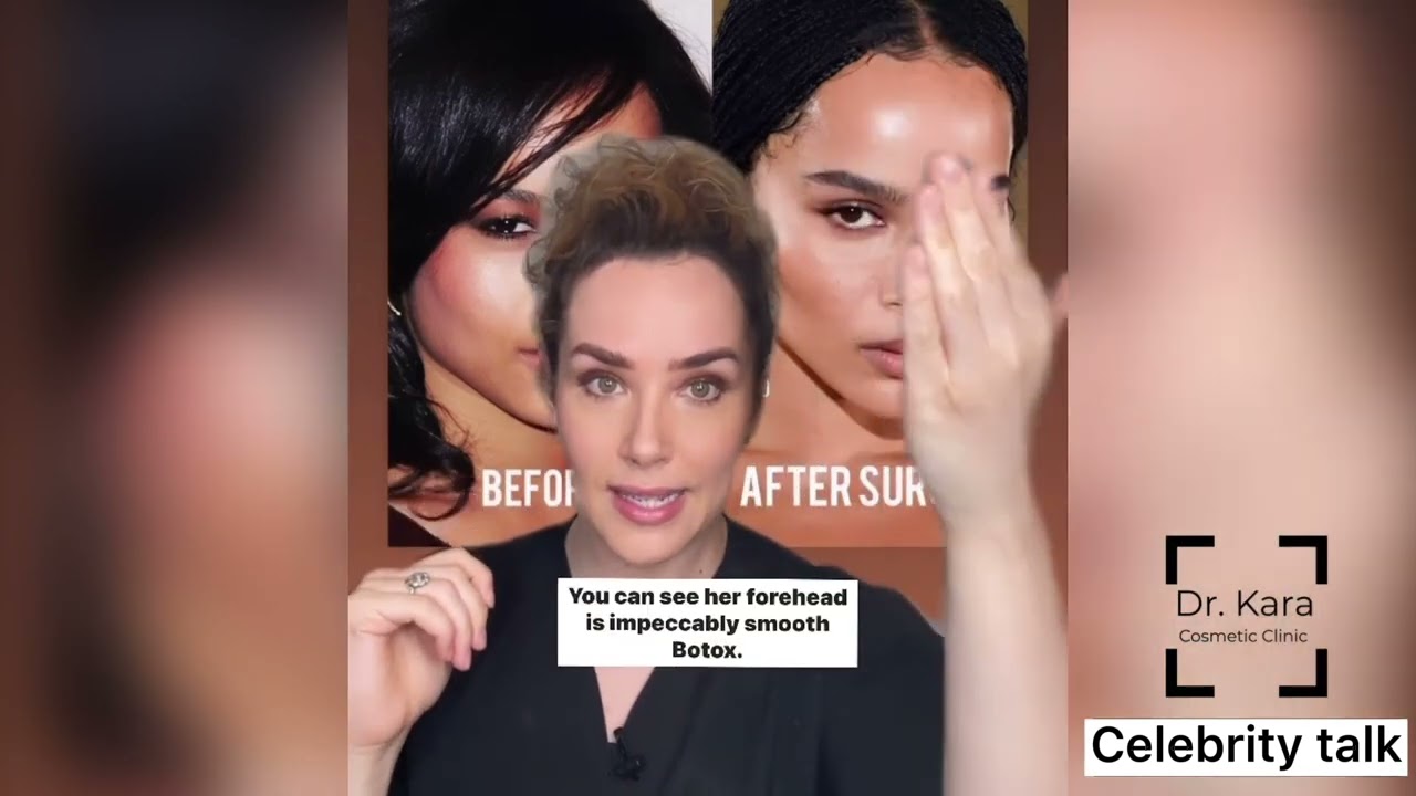 Celebrity aesthetics - What has Zoe Kravitz had done to age like a fine wine