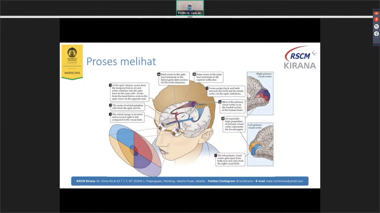 Webinar Series RSCM Kirana: Pengenalan Mata Minus untuk Awam