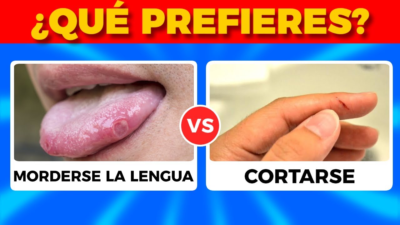 ¿Qué Prefieres? 😱 NIVEL EXTREMO 🔥 Decisiones difíciles - Quiz Mania