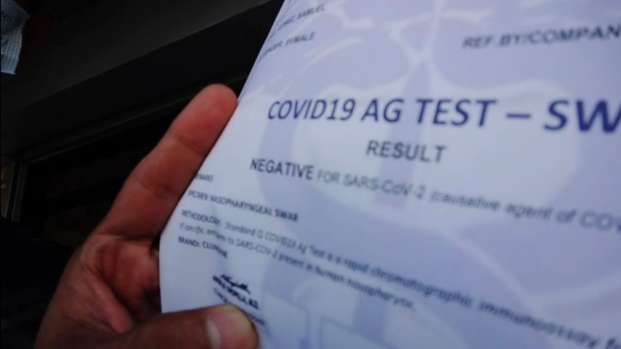 Negative Result Antigen Test kailangan sa Checkpoint pa Bicol